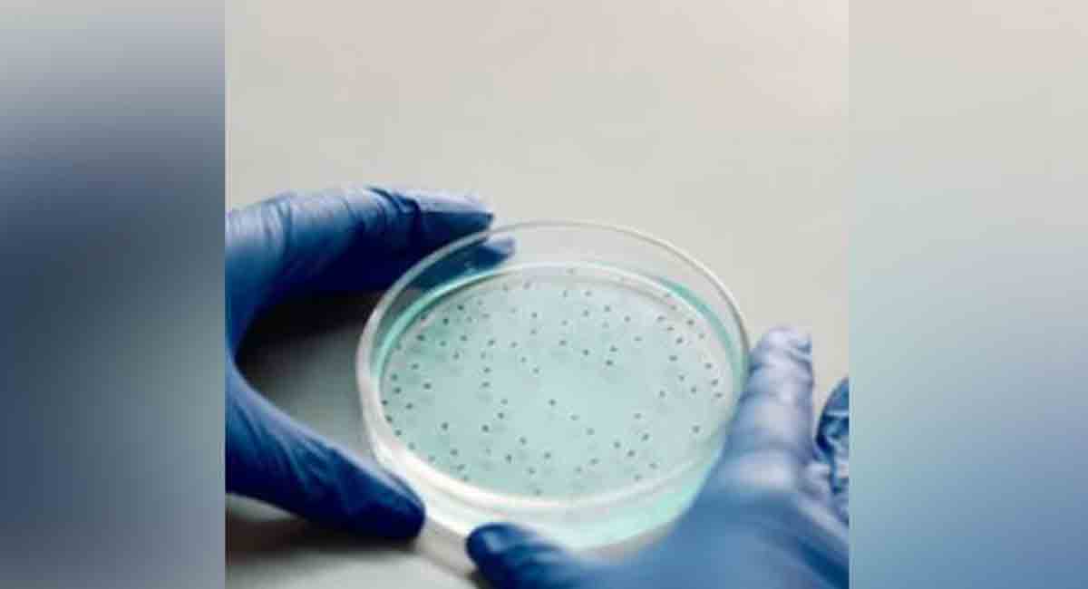 Ilmuwan temukan tipe baru ‘bakteri pecinta plastik’